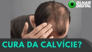 Finalmente? Cura para calvície pode ter sido descoberta