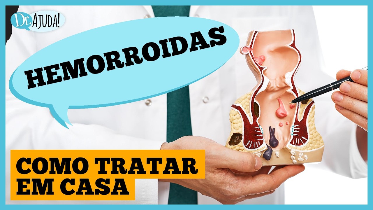 HEMORROIDA tem cura sem cirurgia?