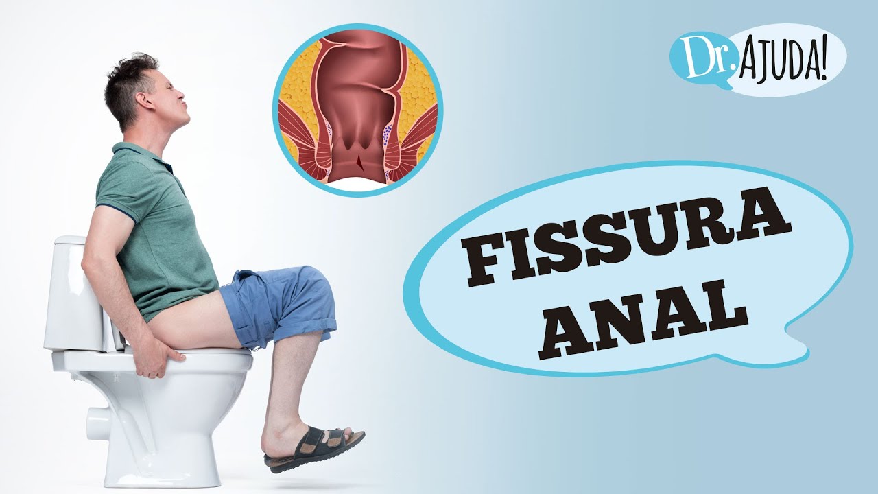 FISSURA ANAL: O QUE É, CAUSAS E O QUE FAZER ?