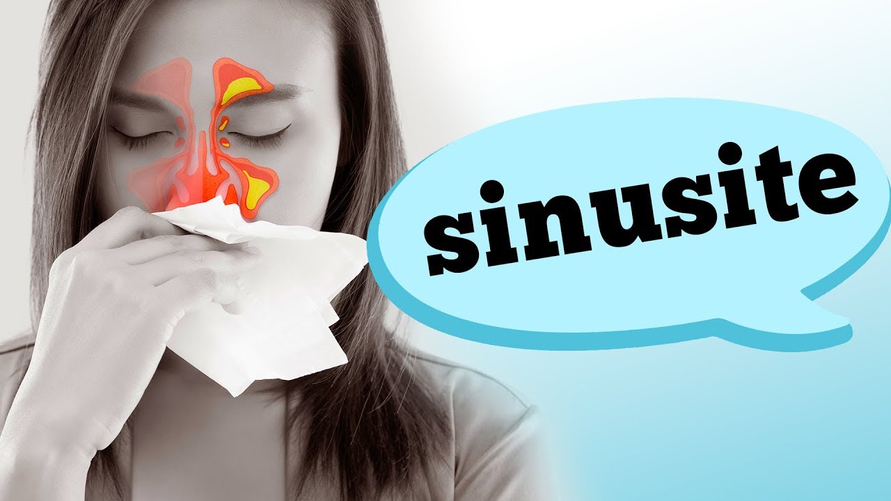 SINUSITE: CONHEÇA OS SINTOMAS E TIPOS DIFERENTES