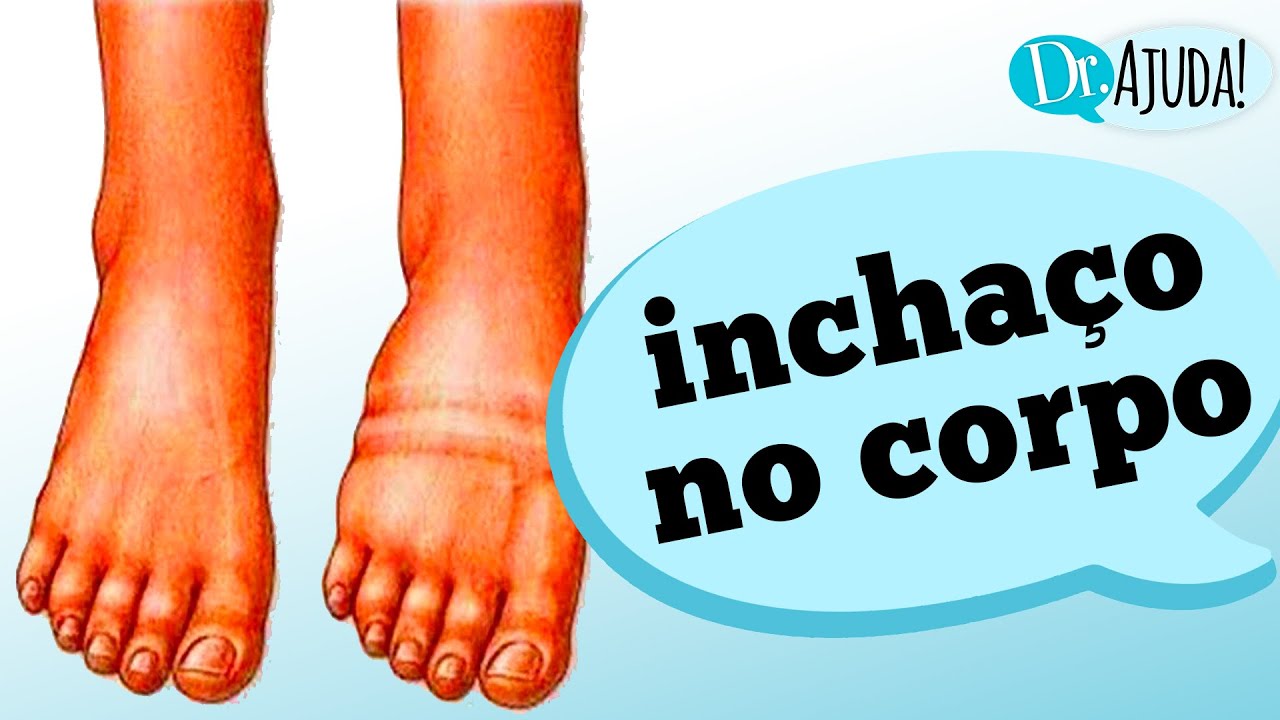 O que causa INCHAÇO pelo corpo?