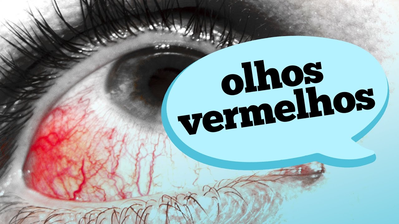 O QUE CAUSA OLHOS VERMELHOS?