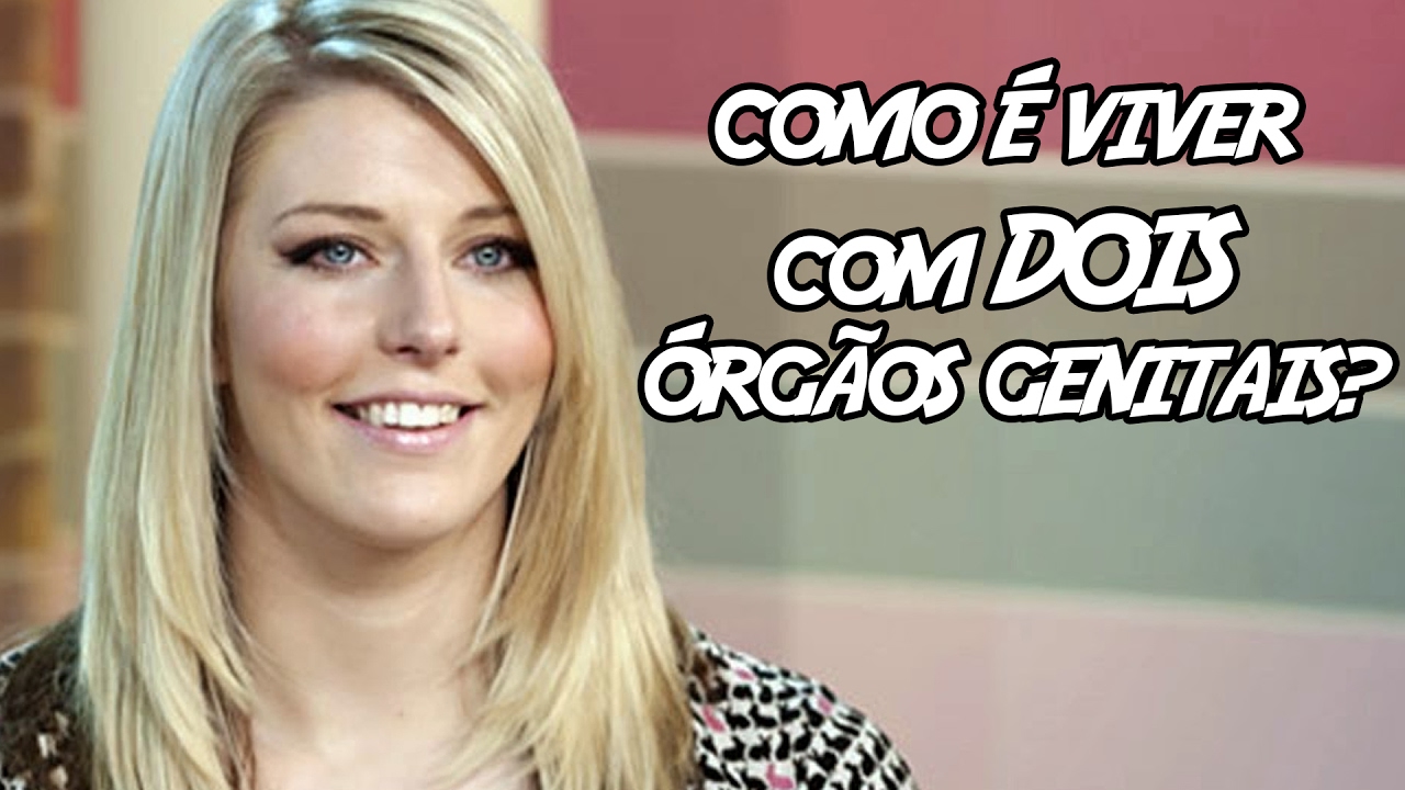 5 pessoas que chocantemente possuem partes extras no corpo