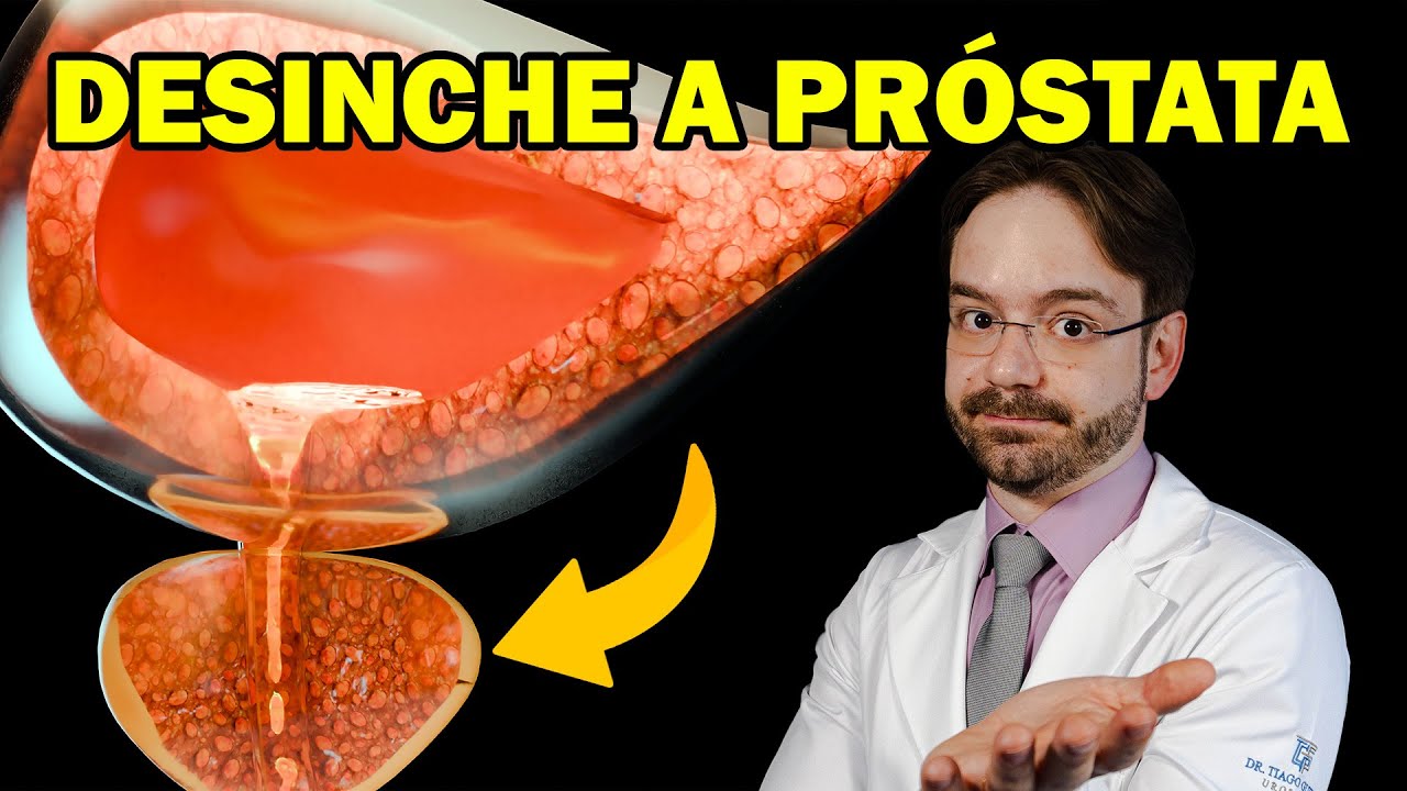 A Verdade Sobre a Próstata: Porque Ela Cresce Depois Dos 40!