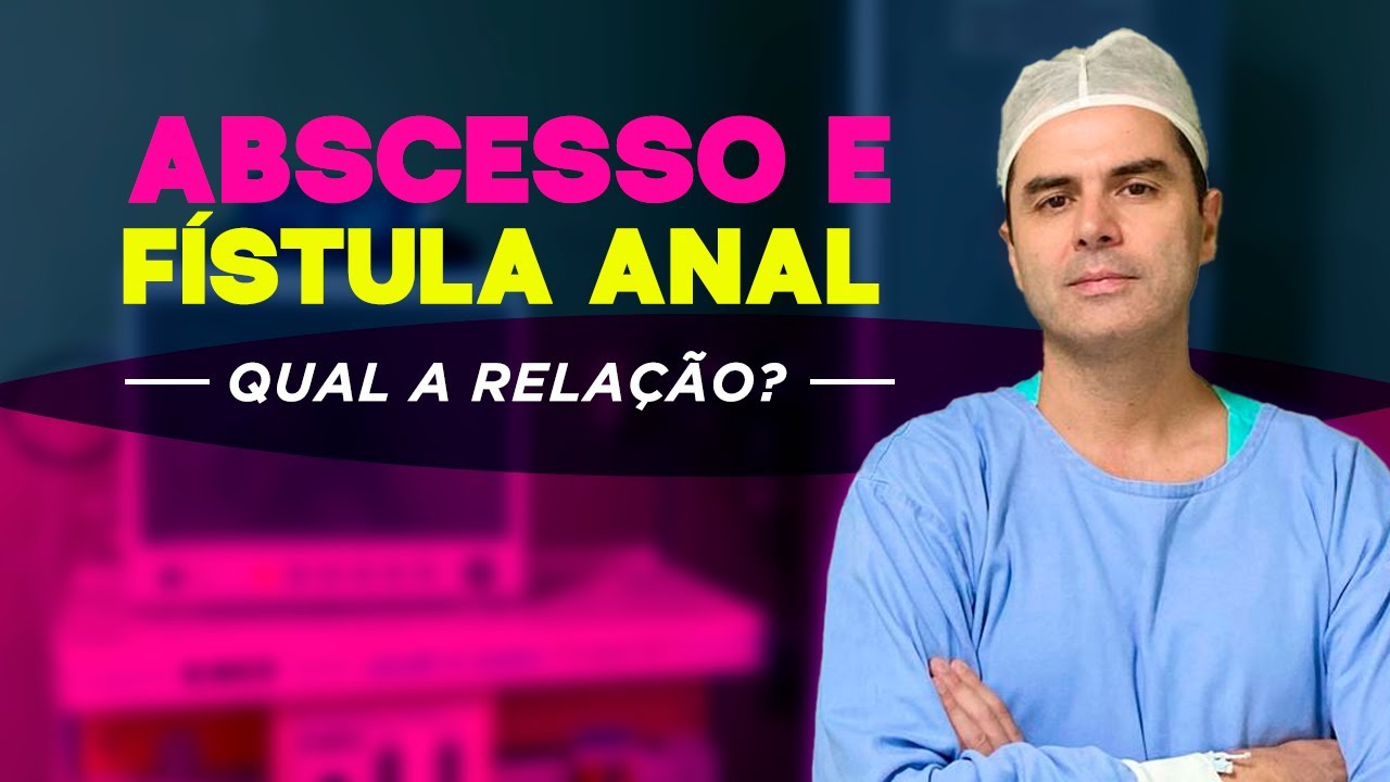 Abscesso e Fístula Anal! Dr. Fernando Lemos – Proctologista / Planeta Intestino.