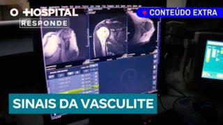 Conheça os sinais da vasculite e proteja sua saúde | O Hospital Responde