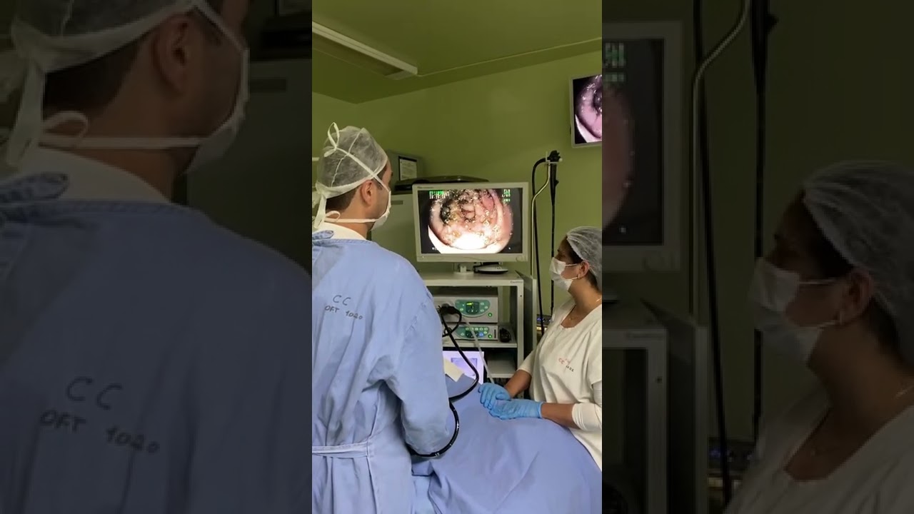 Infestação por VERMES na COLONOSCOPI0!  Dr.Fernando Lemos – Planeta Intestino.